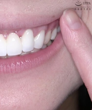 AD-817 浜辺ことり