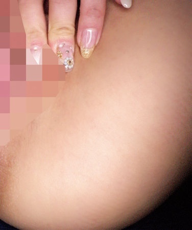 ORETDA-004 